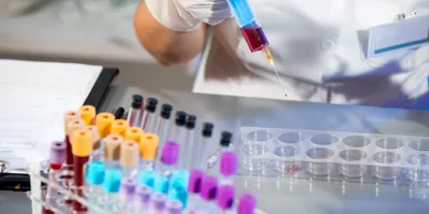 Scientist handling test tubes and pipette.