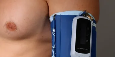 Home Blood Pressure Monitoring (HBPM) - £100