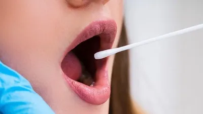 Person receiving oral swab test.